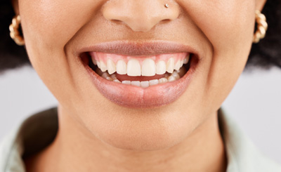 a close-up of a patient’s gumline