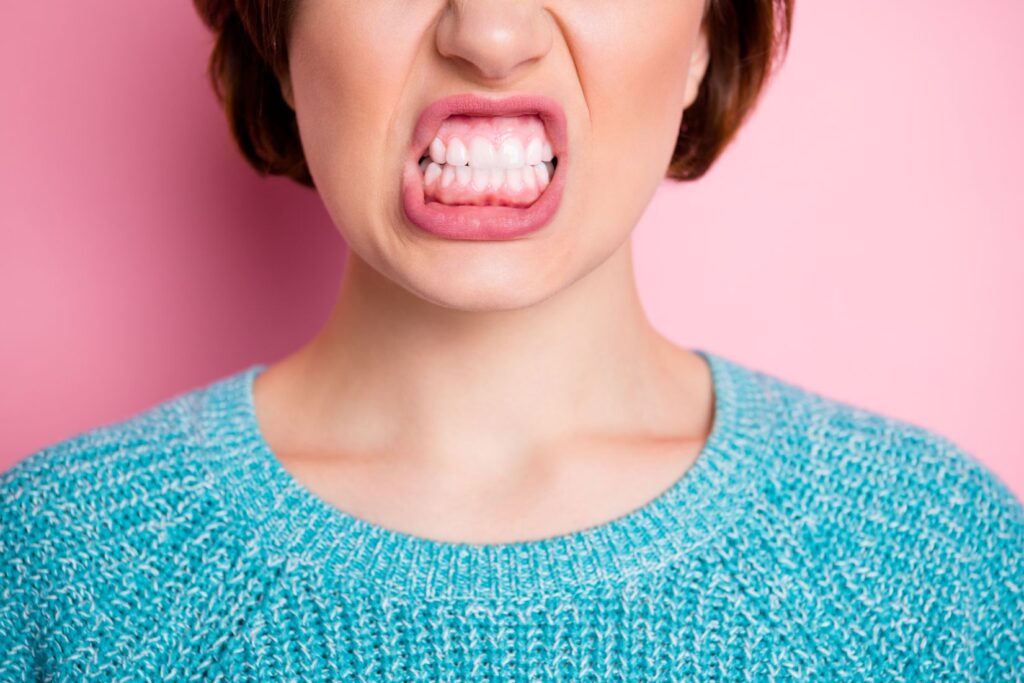 A closeup of a woman’s teeth and gums.