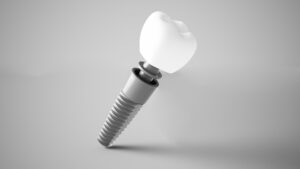 Implant, abutment, and crown featured against gray background